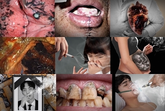 담뱃갑 경고그림. 사진 제공=보건복지부